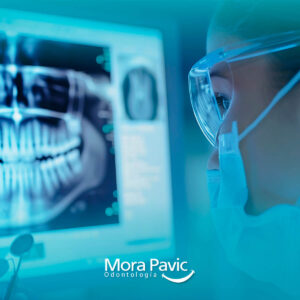 Pack de Radiografías Dentales Completas